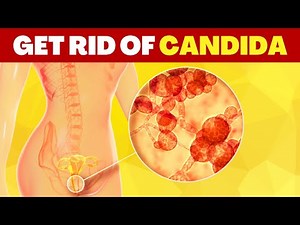 HOW TO TREAT CANDIDA NATURALLY in 5 STEPS