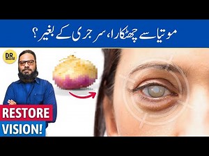 Safed/Kala Motia Ka Ilaj, Bina Surgery! Treating Cataracts Without Surgery | Dr. Ibrahim
