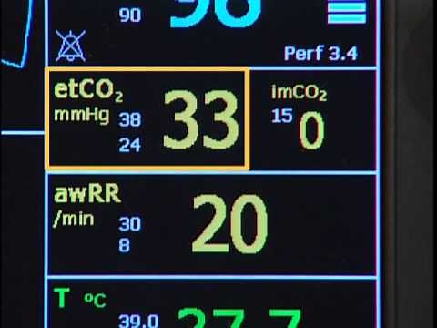 Setting Up Microstream CO2 VM Series