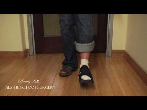 How to walk with the Post Op Shoe