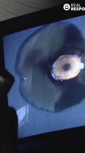 10K views · 73 reactions | Discover how the shape of a tree root's water-conducting tissue can reveal its age. The xylem, responsible for carrying water, forms a triangle shape in young roots, indicating they are about a year old. It's amazing what we can learn from nature! Have you ever noticed this? #trees #roots #xylem #botany #nature #science | Real Responders | Facebook