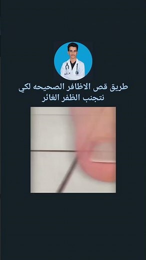 الطريقه الصحيحه لقص الاظافر لتجنب الظفر الغائر #دكتور_سيرجن