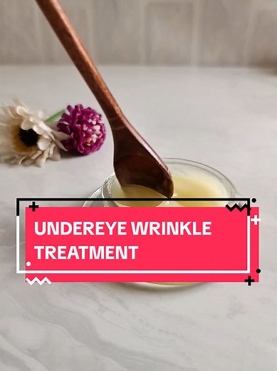 undereye wrinkle treatment. #antiaging #antiwrinkle #naturalremedy #skincare