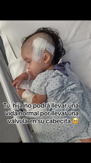 Hidrocefalia en Bebés: Comprendiendo la Condición