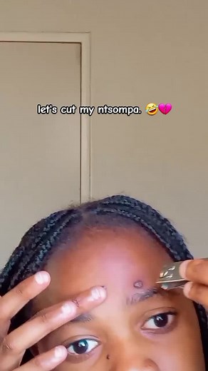 Understanding Ntsompa: Causes, Removal, and Cutting Techniques