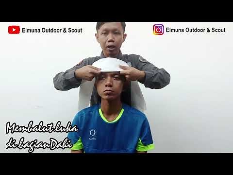 Wound dressing with MITELA