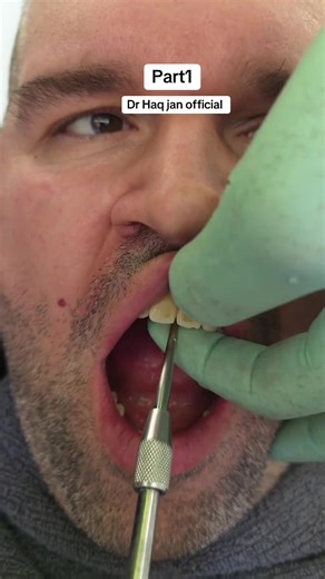 Understanding Teeth Removal Procedures