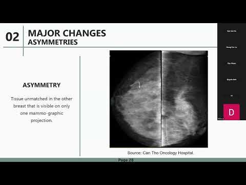 Bài 47 - Updates in BI-RADS 2025 Lexicon - What's new in mammography? - Truong Tuong Vi, MD
