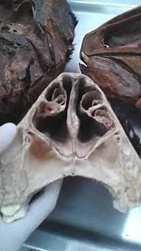 Concha, meatus - nasal cavity