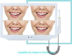 Dental Endoscope Integrated Intraoral Camera & Monitor High Defination