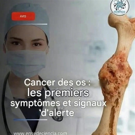 Symptômes du cancer des os : signes d'alerte à ne pas ignorer. | C'est le Prénom.