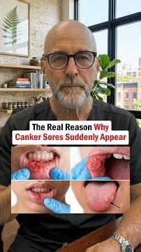 The Real Reason Why Canker Sores Suddenly Appear #cankersores #oralhealth #mouthulcers #health