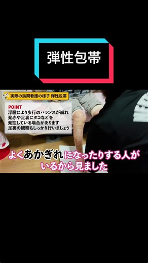 弾性包帯によるむくみ取りの実際の様子
