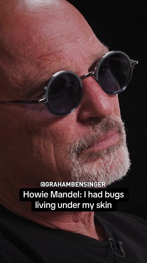 Howie Mandel: sand fly larvae under skin explained