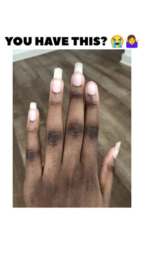 Knuckles Brightening remedy ✨😳#knuckles #remedy #glowup #beautytips #fypシ #shorts