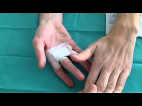 L'auto rééducation après chirurgie du doigt à ressaut