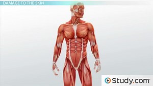 Causes and Consequences of Damage to the Skin