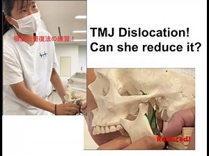 How a TMJ Dislocation Happens—and How Clinicians Practice Reduction Technique without Risk!