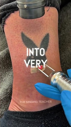 How Tatto Remove Machine Work?🤖 Explained By The Singing Teacher