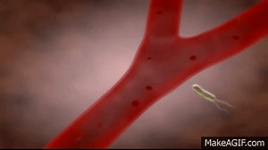 Sepsis Presentation on Make a GIF