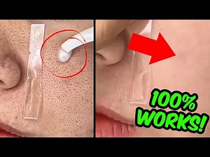 How To REMOVE Large Open Pores From Face & Nose Permanently Naturally At Home