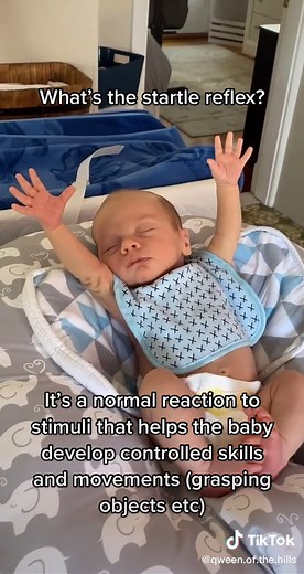 Is it the startle reflex or is my son a born orchestra conductor?? #babiesoftiktok #babyboy #momsoftiktok #childdevelopment #milestone #fyp