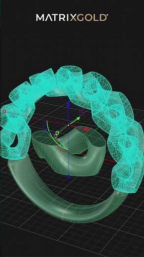 chain-link ring MatrixGold