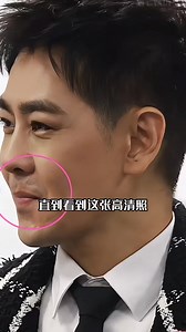 665K views · 2.3K reactions | 林志颖花300万修复容貌，一张高清照才知，车祸后遗症显而易见 #林志颖 #胡歌 #俞灏明 #娱乐 #八卦 | 越娱乐 | Facebook