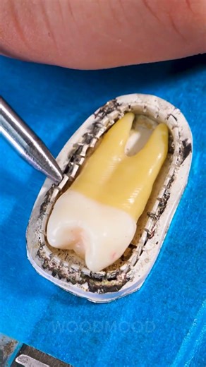 Unique jewelry - tooth made into a necklace🦷