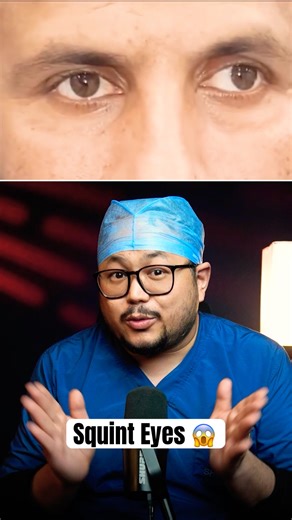 On n off squint ? But why - intermittent divergent squint | Dr. Bhanu Explains