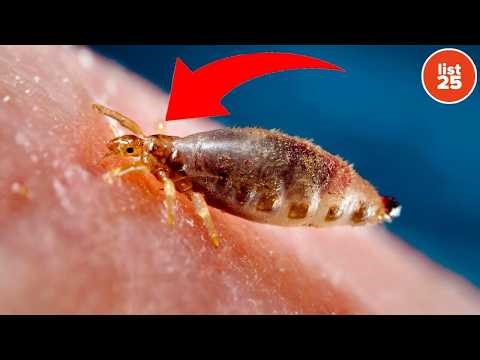 25 Insects That Call Human Bodies Their Home
