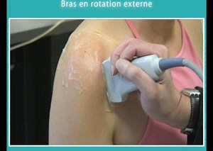 Débuter en écho-anatomie de l'épaule