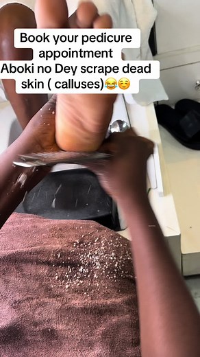 Effective Callus Removal Tips for At-Home Pedicures