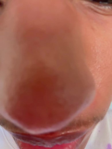 braceface.katso (@braceface.katso)’s videos with And Im outta here - Kayla rnb❤️‍🩹