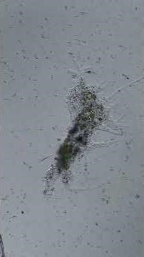 microscopy video - large amoeba