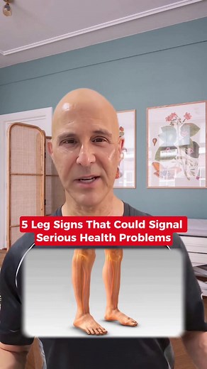 5 Leg Signs Indicating Serious Health Issues