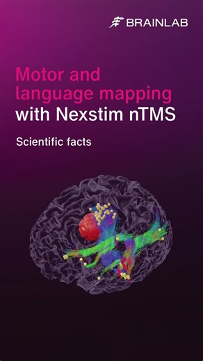 Infographic: Nexstim x Brainlab