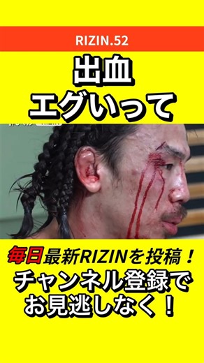 矢地祐介の血の量がヤバイ【ギョンピョの左ヒジが炸裂！】 #RIZIN #朝倉未来