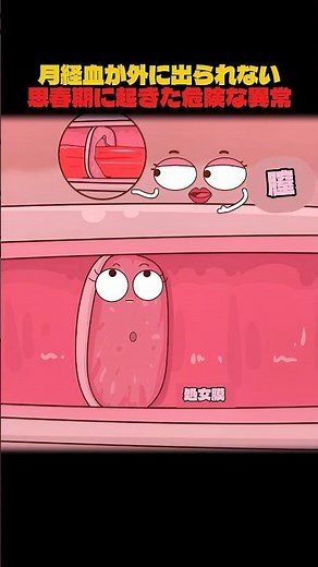 月経血が外に出られない思春期に起きた危険な異常 #animation #状態異常 #アニメ