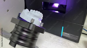 3d jaw scanning in modern dentistry. Dental prosthetic restoration. Dentist making 3D model for sculpted plastic denture with high tech digital scanning equipment. 4 k video Stock Video