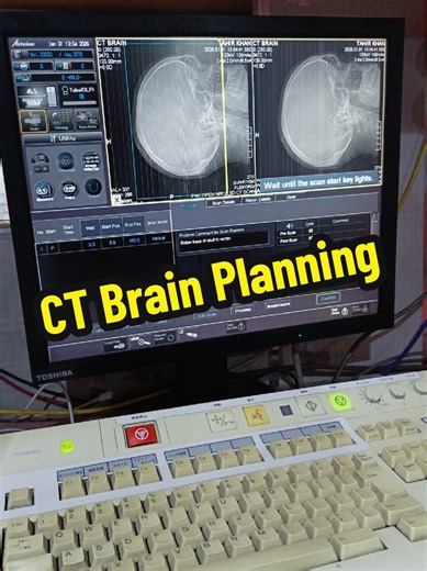 CT Brain Planning #Radiologyacademy #ctscan #radiology #hospital