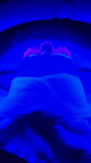 ¿Piel con acné o inflamación?La luz LED azul es tu nueva aliada.Este...