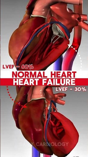 NORMAL HEART vs HEART FAILURE #shorts #heartanimation #cardiology #anatomy #hearthealth