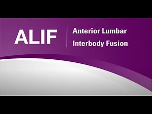 Nuvasive: ALIF Animation