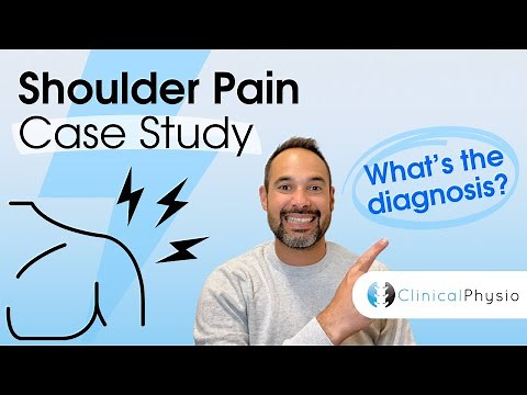 Shoulder Pain Case Study | Expert Physio explains Assessment, Diagnosis and Clinical Reasoning!