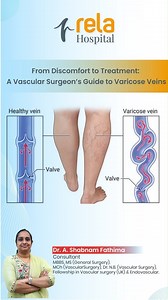 38 reactions · 3 comments | Do you have aching, swollen legs or...