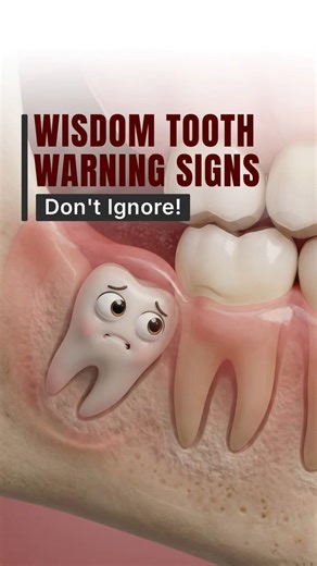 Wisdom Tooth Warning Signs You Should Never Ignore