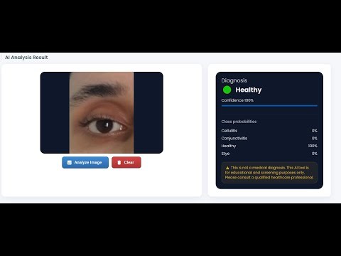 AI Eye Detection — Dual Model Classifier