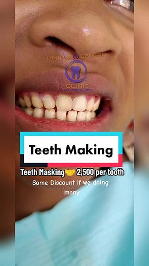 Teeth Whitening Procedure Revealed: Transform Your Smile