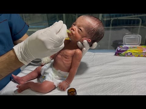 Day 3 Baby Asim Oral Thrush – Newborn Not Feeding Properly | NICU Baby Update👶😕